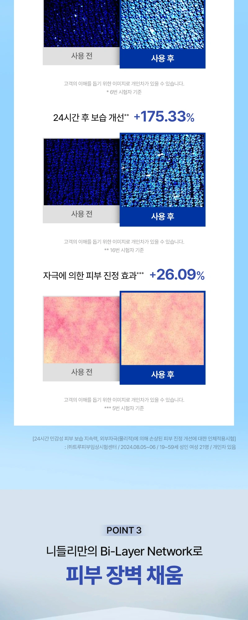 니들리 에이 투 로션 상세 페이지 작업